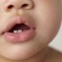 Зубная боль у малыша: основные симптомы