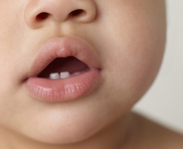 Зубная боль у малыша: основные симптомы